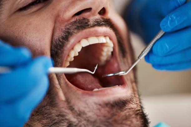 Best Walk-In Emergency Dentist in Hebron, NE