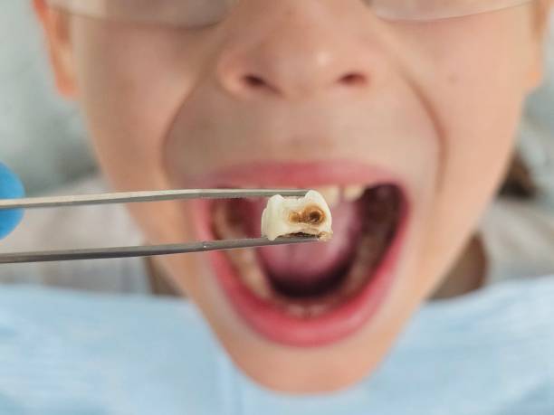 Best Pediatric Emergency Dentist in Hebron, NE